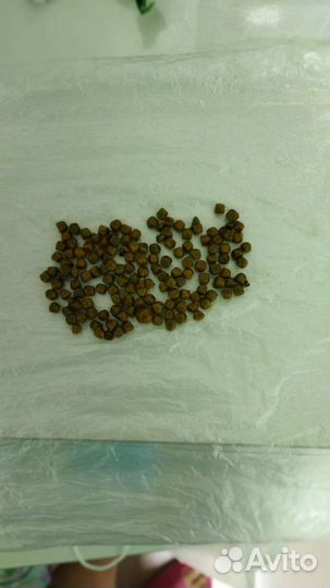 Камни из желчного пузыря человека