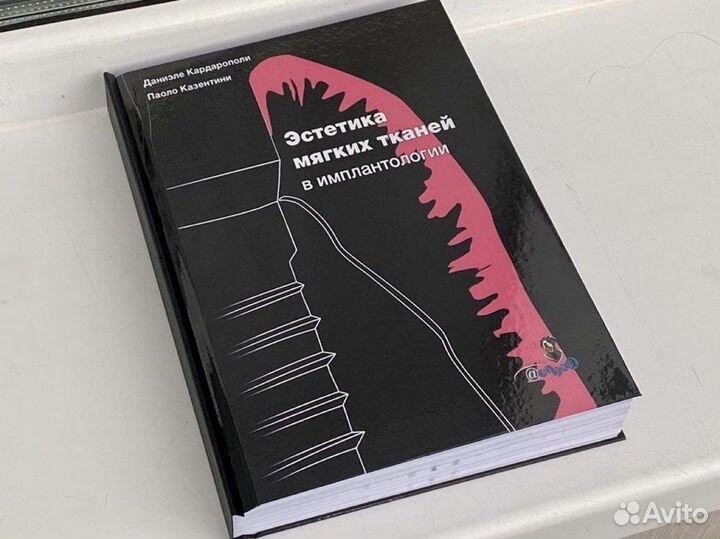 Эстетика мягких тканей в имплантологии