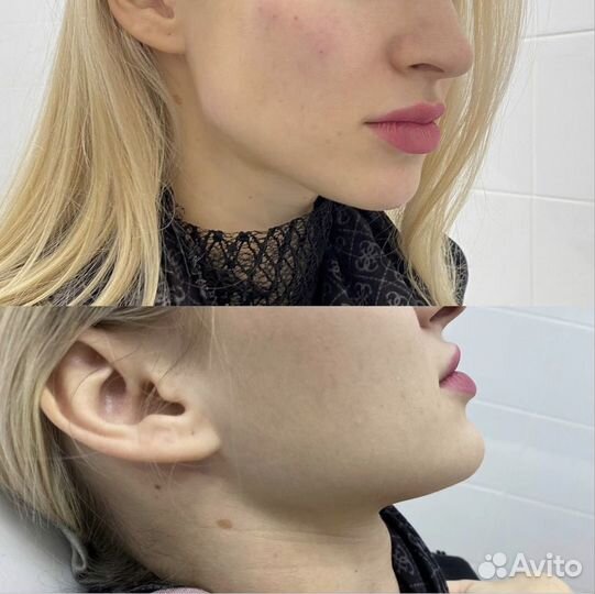 Губки бантик