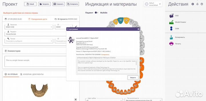 Exocad 3.1 / Exoplan 3.1 Rijeka build 8349 / 8423