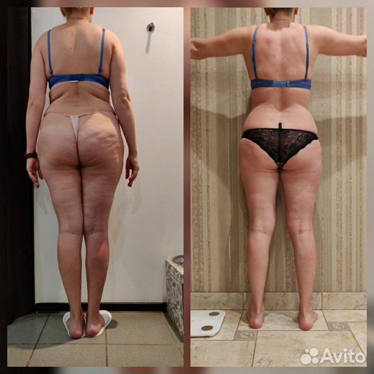 Мастер по коррекции фигуры и лица