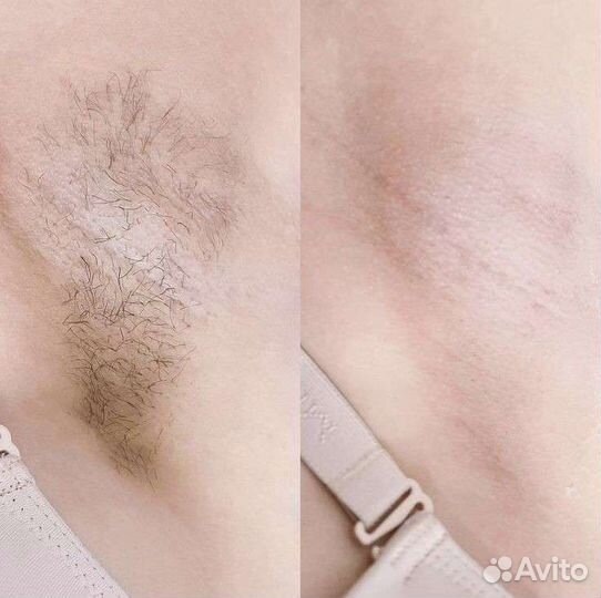 Шугаринг, Брови