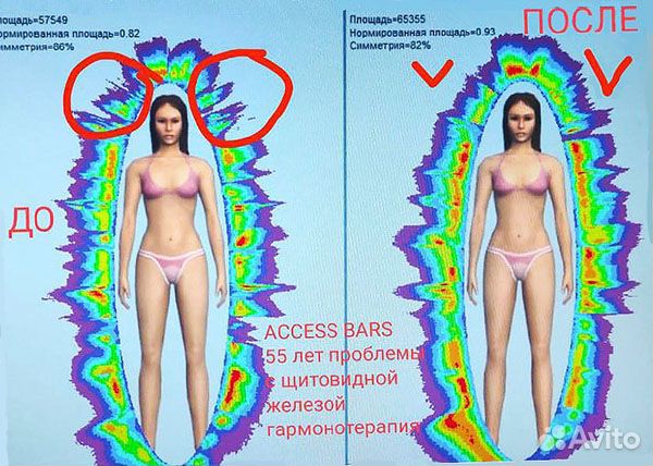 Аксесс барс / Access bars энергомассаж