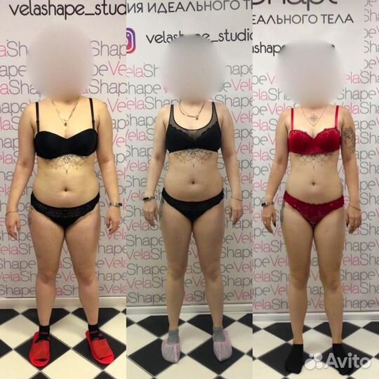 Антицеллюлитный массаж Коррекция фигуры. Похудение