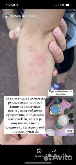 Взбитое масло Ши крем заживляющий