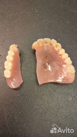 Ремонт зубных протезов