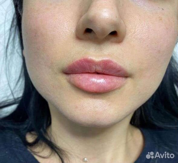 Услуги косметолога