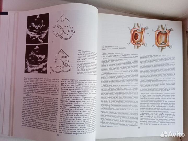 Сердечно-сосудистая хирургия руководство