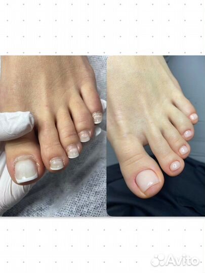 Аппаратный маникюр