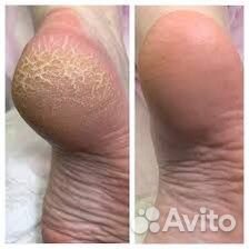 Комбинированный маникюр