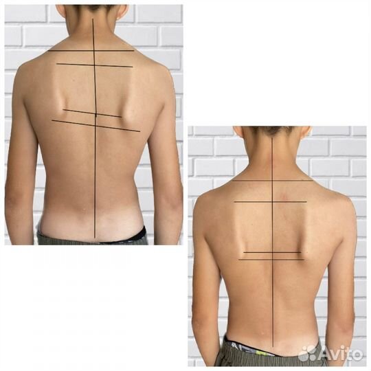 Костоправ мануальщик