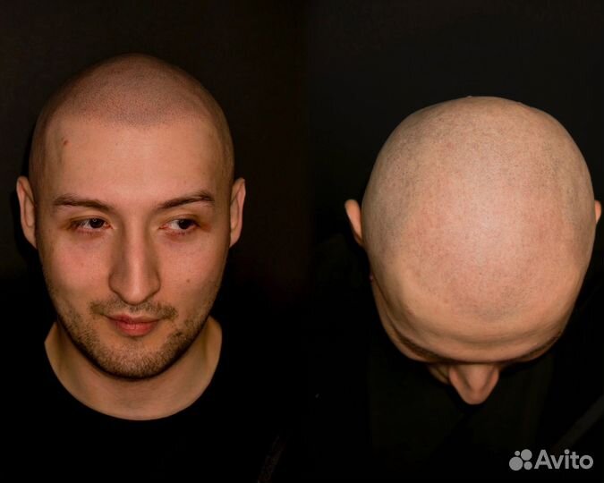 Тату волос SMP трихопигментация