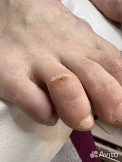 Мастер педикюра подолог