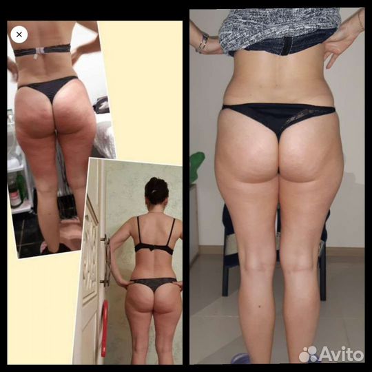 Программа похудения за 10 дней