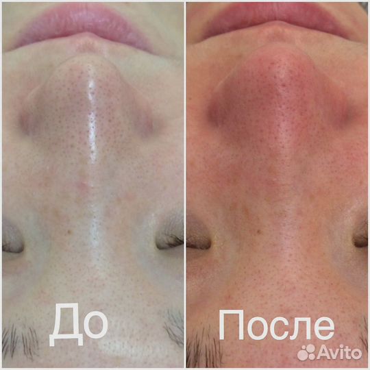 Косметологические услуги