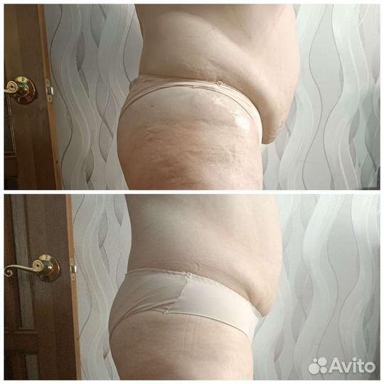 Массаж,коррекция фигуры,Марафон