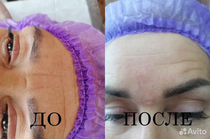Услуги косметолога