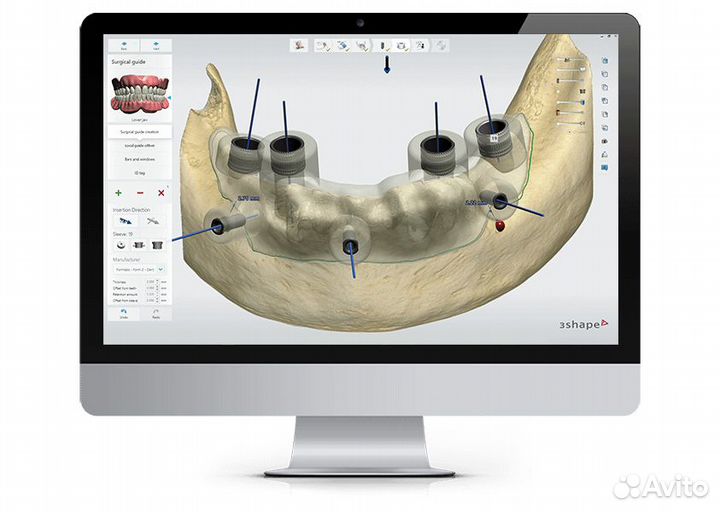 3shape unite 2023 все модули / Dolphin 11.5 - 12