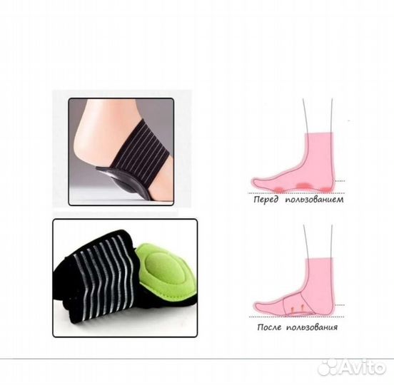 Супинатор ортопедические