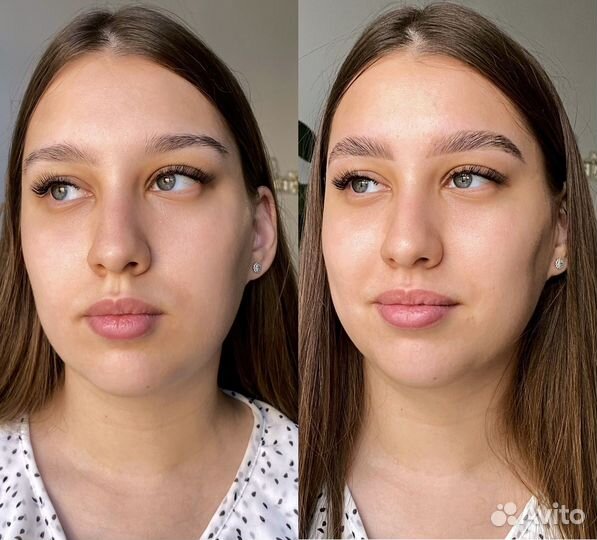 Брови Бугры