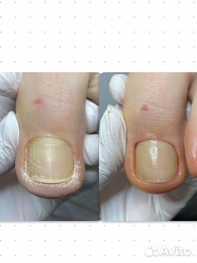 Аппаратный маникюр