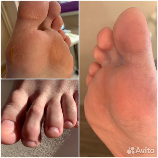 Подолог, педикюр