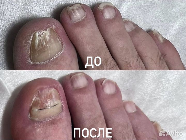 Подолог с выездом на дом