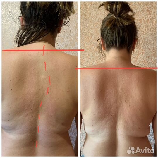 Массаж классический