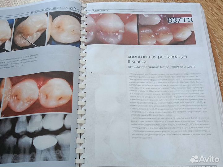 Эстетическая и реставрационная стоматология