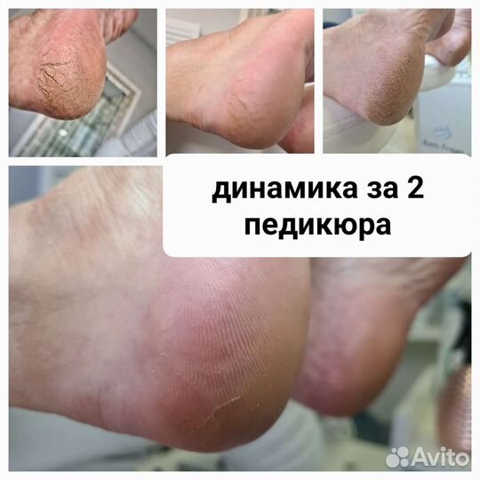 Маникюр, дисковый и kart педикюр. Выезд на дом