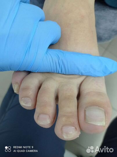 Педикюр любой сложности