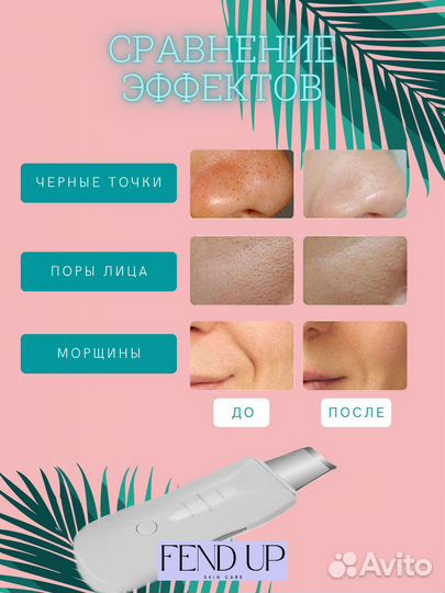 Аппарат для Ультразвуковой чистки лица