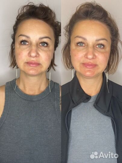 Услуги косметолога в Калининграде