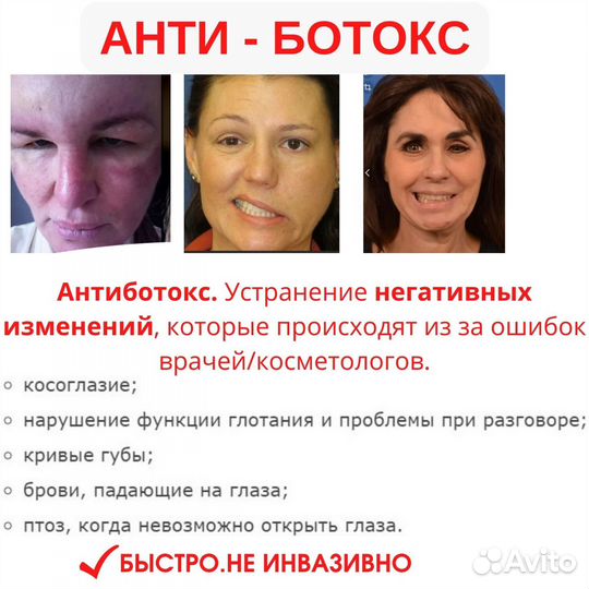 Массаж лица пластический, бмс Назарова,ищу модель