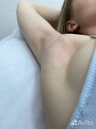 Депиляция шугаринг воск Макеевка Донецк днр