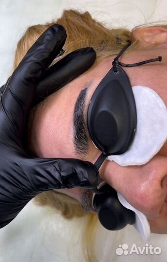 Удаление тату и перманентного макияжа