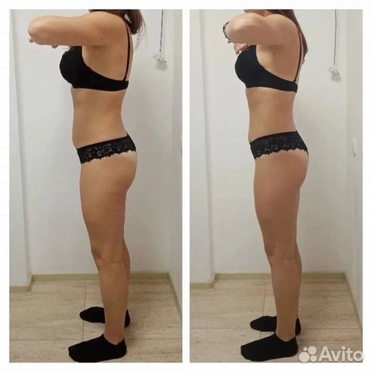 Модель на ботокс лица