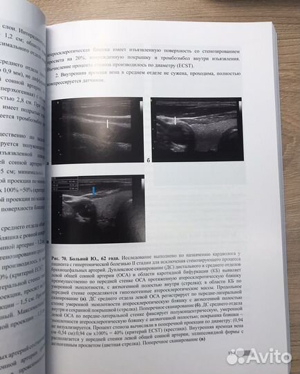 Книга по дуплексному сканированию сосудов шеи