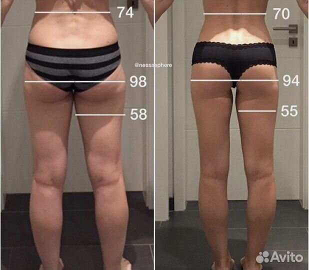 Коррекция фигуры аппаратный массаж