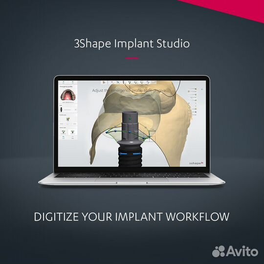 3shape unite 2023 все модули / Dolphin 11.5 - 12