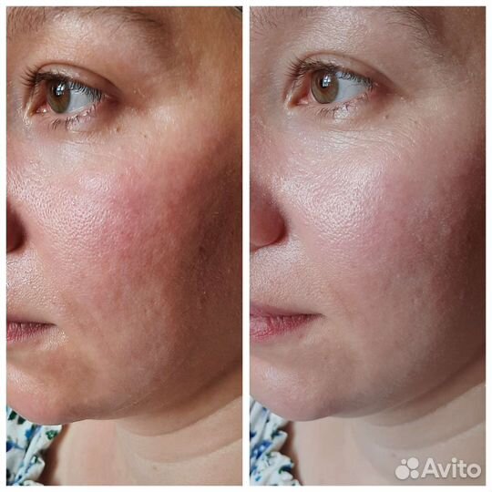 Услуги косметолога