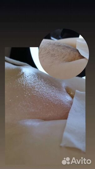 Шугаринг, депиляция