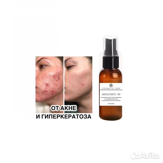 Сыворотка от гиперкератоза и акне
