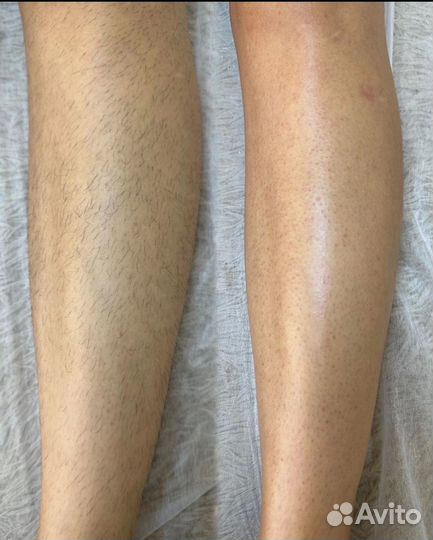 Восковая депиляция (Первомайский район)