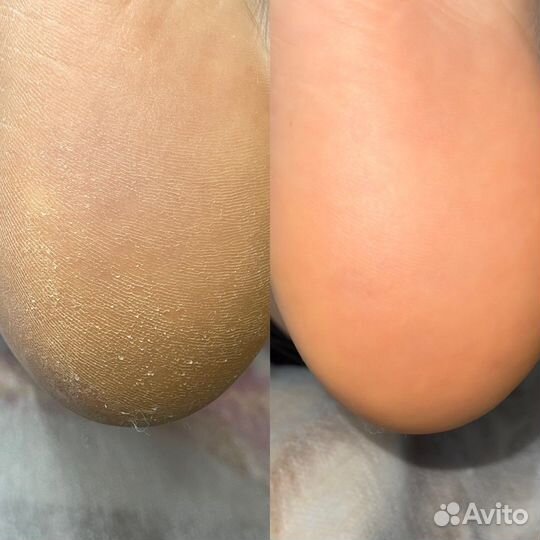 Подолог Волгоград