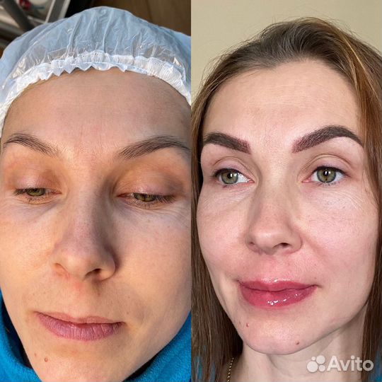 Перманентный макияж и лазерное удаление пм