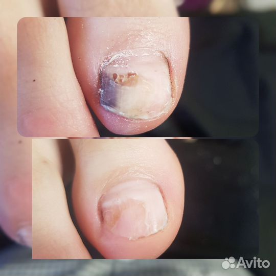 Педикюр Маникюр