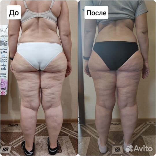 Массаж коррекции фигуры акция