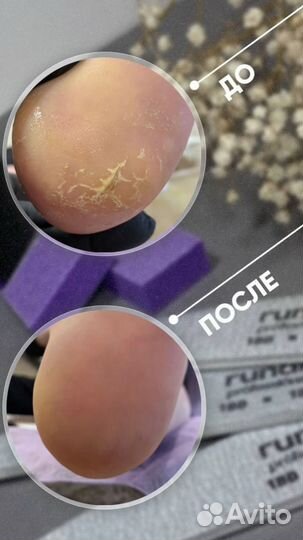 Педикюр женский