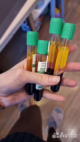 Плазмолифтинг волос/лица, prp терапия 2 пробирки